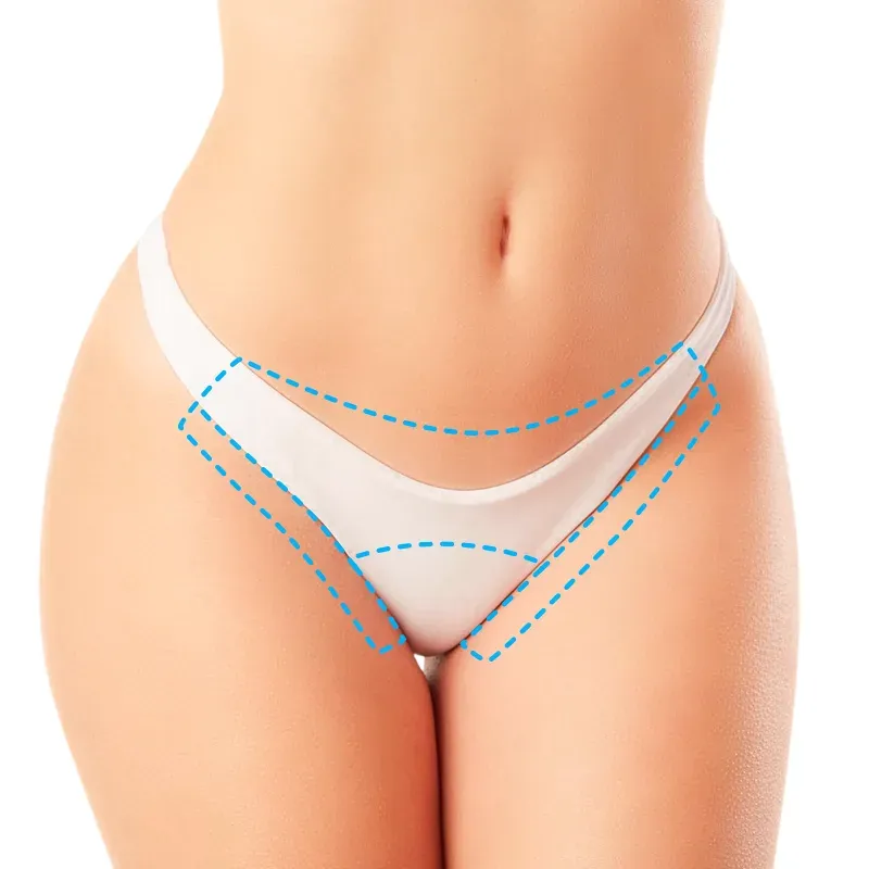 New Image Spa - Depilacion Laser Treatment