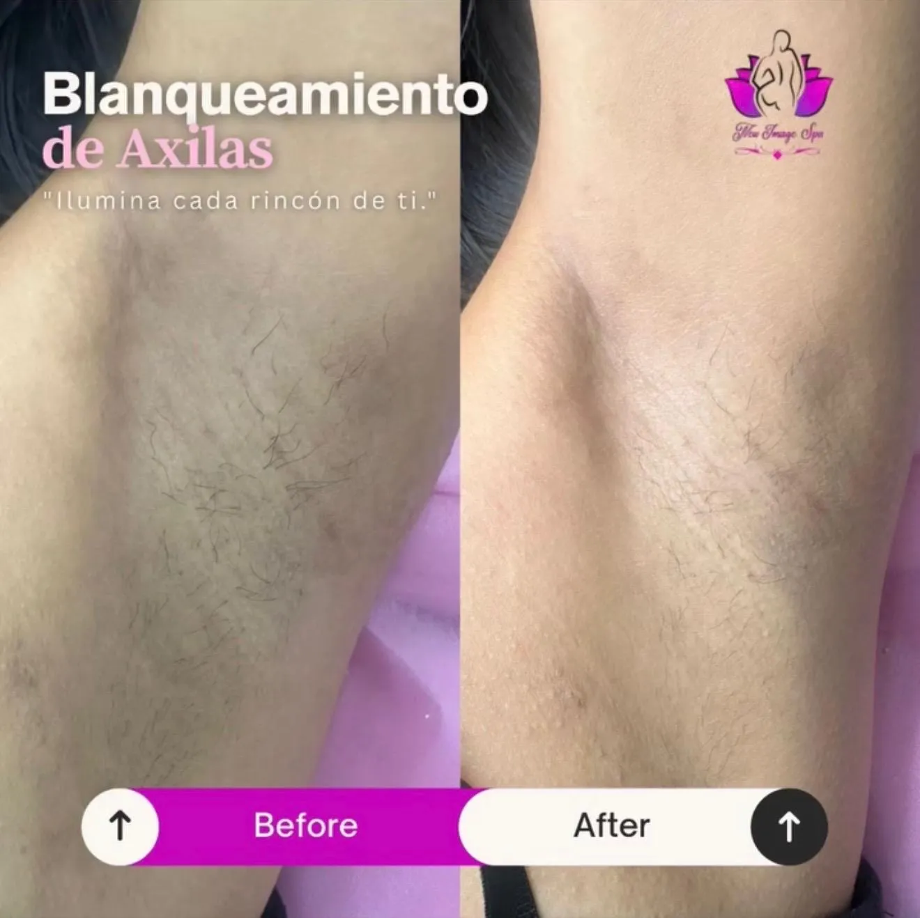 Axilla brightening transformation