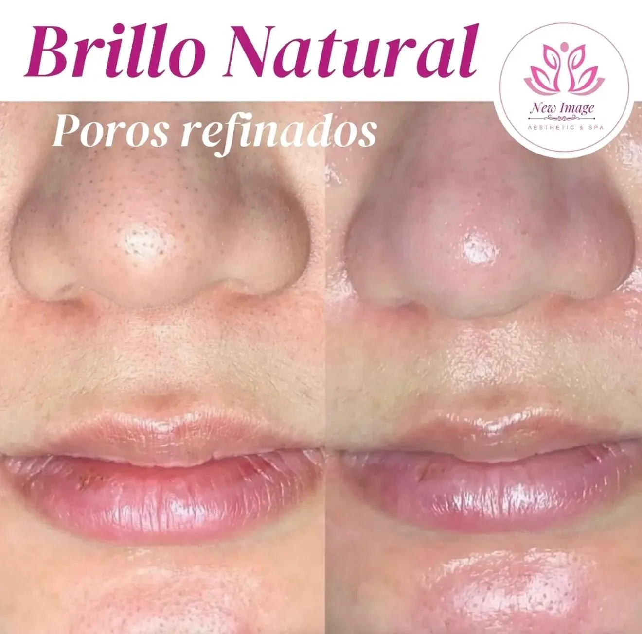 Natural glow transformation