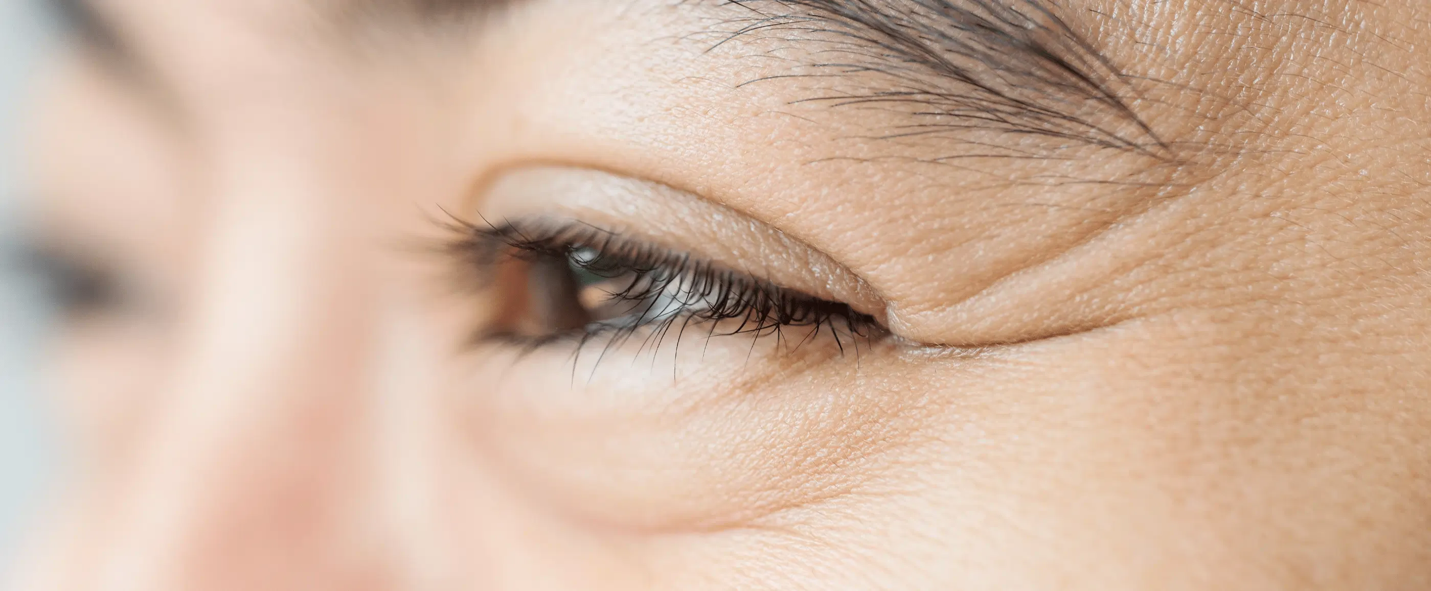 Full Botox treatment - New Image Spa
