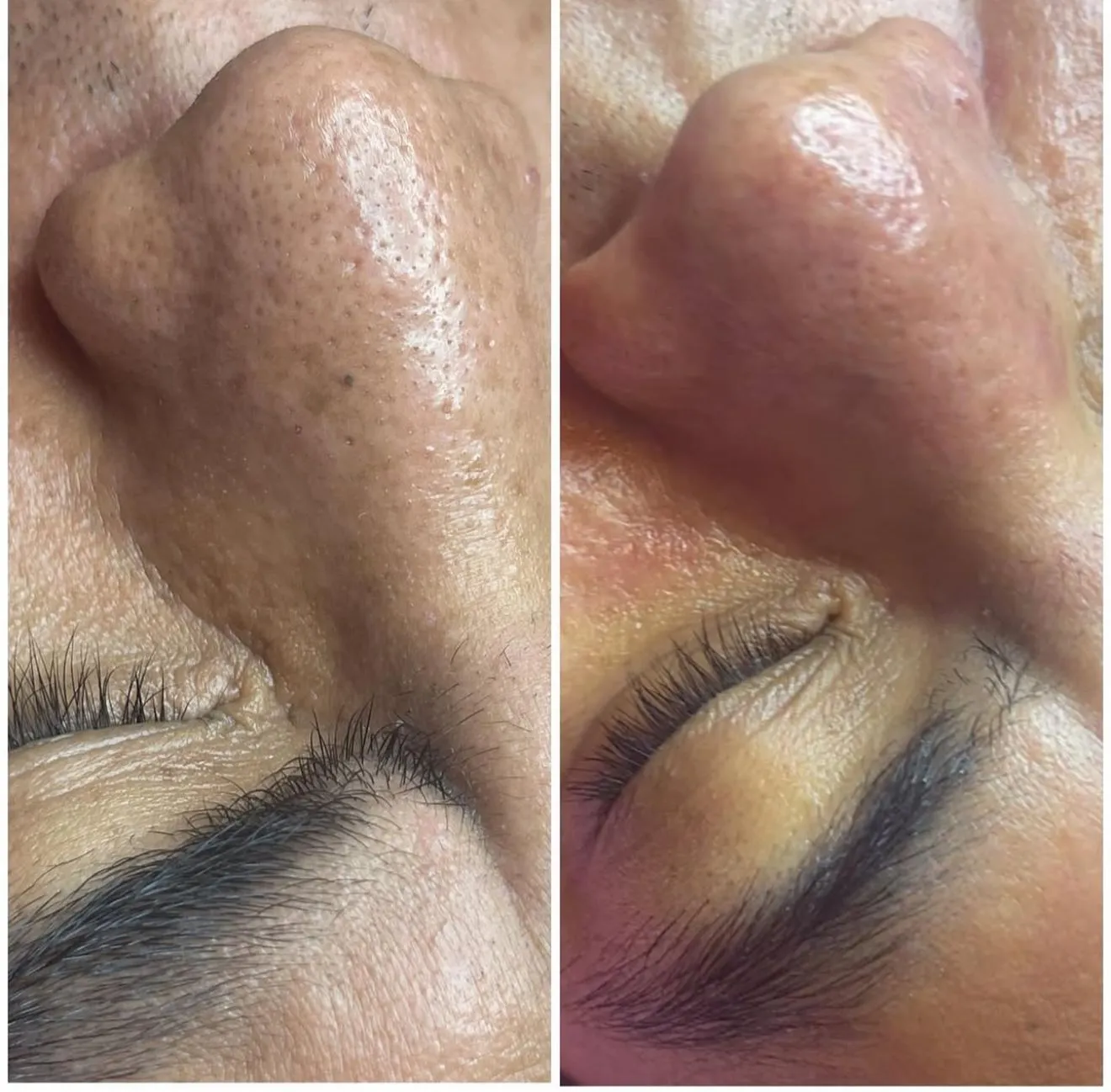 Deep facial transformation