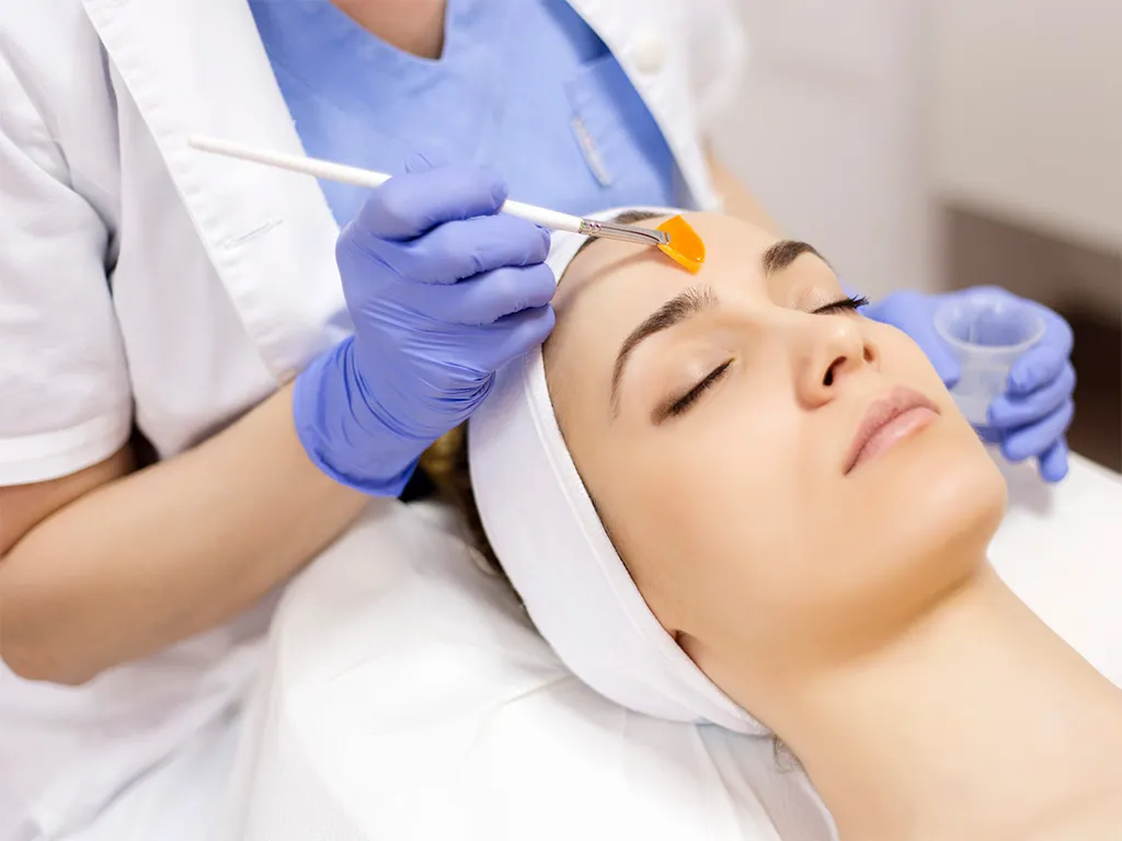 Anti-Acne Chemical Peel