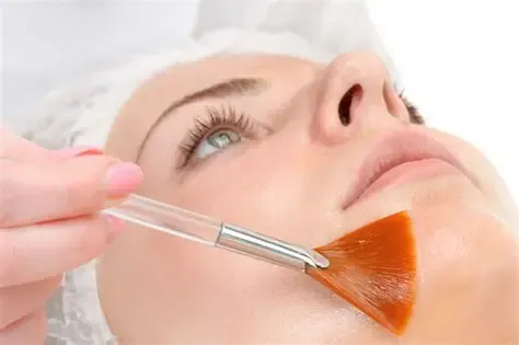 Anti-Aging Chemical Peel