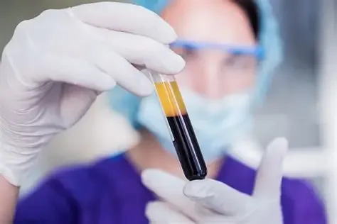 Platelet-Rich Plasma