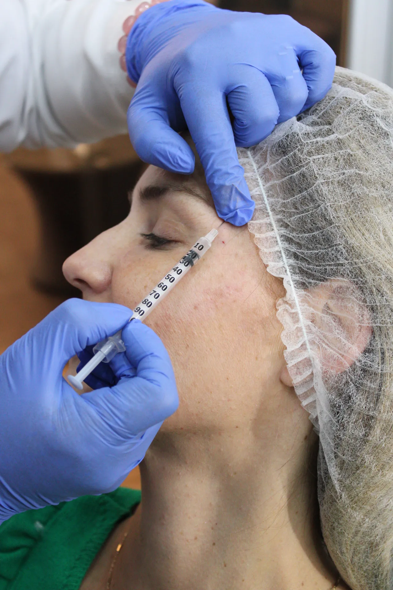Botulinum Toxin
